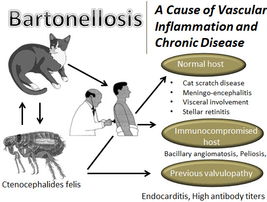 Medical Webinars On Bartonella Infection